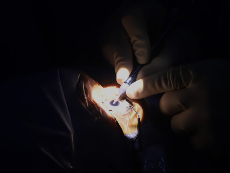 A catarata é responsável por 51% dos casos de cegueira no mundo, mas a Prefeitura de Búzios está empenhada em tornar essa realidade diferente no município - Ronald Pantoja