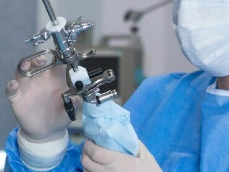 histeroscopia-cirurgica-0d88